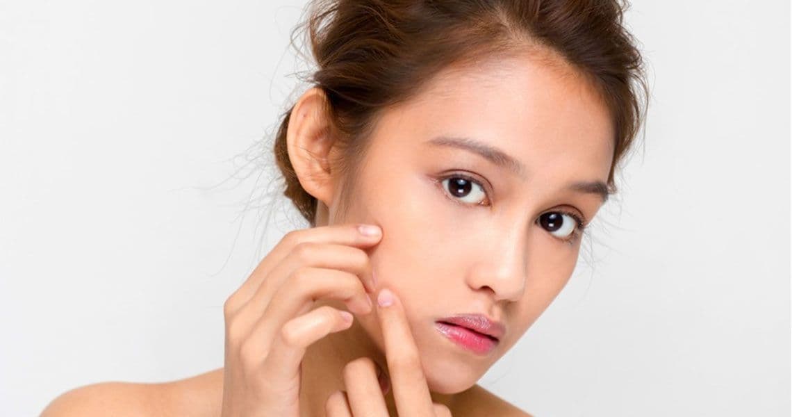 Ketahui Makna Dibalik Timbulnya Jerawat di Wajah & Tubuhmu dari Kaca Mata Medis